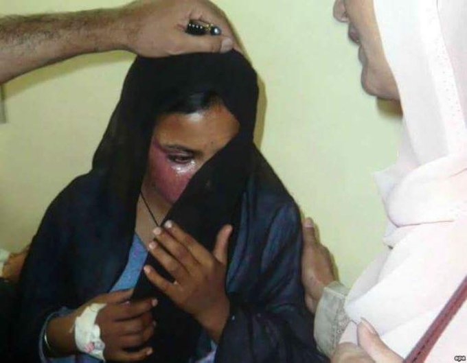 25-Year-Old Christian Woman Burned to Death in Sialkot🇵🇰 After Refusing Marriage Proposal